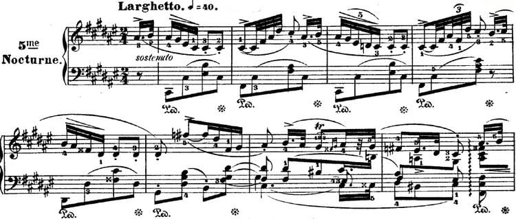 Nocturnes, Op. 15 (Chopin)