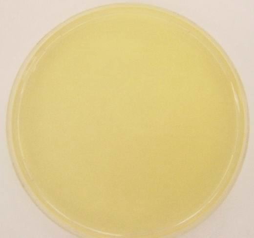Nutrient agar microbeonlinecomwpcontentuploads201603Unino