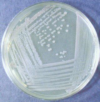 Nutrient agar Nutrient Agar composition preparation and uses microbeonline