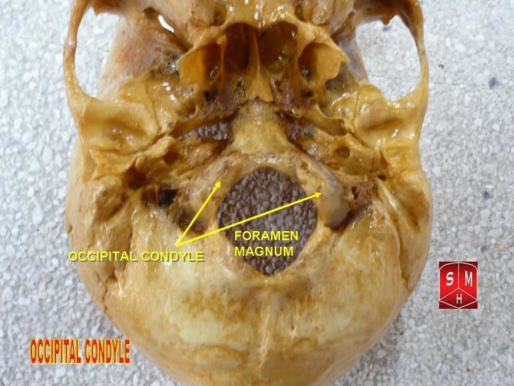 Occipital condyles