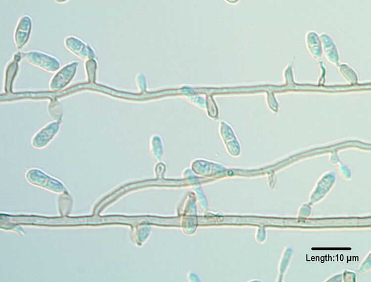 Ochroconis gallopava Melanized Fungi in Human Disease