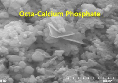 Octacalcium phosphate Tioss gt tioss image gallery 1