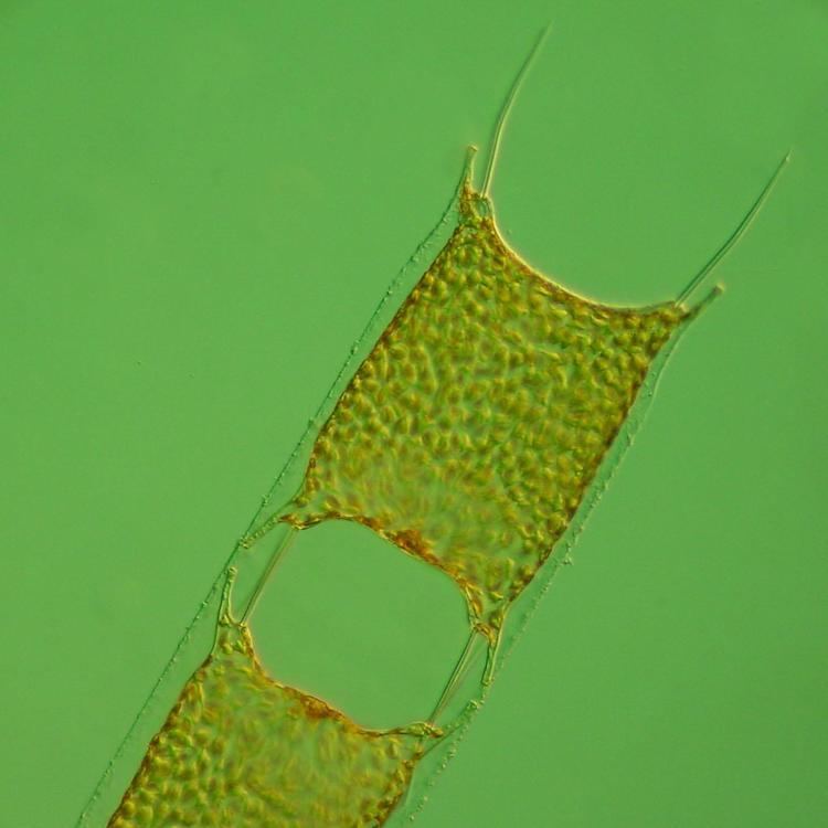Odontella Odontella sinensis Greville Grunow Nordic Microalgae