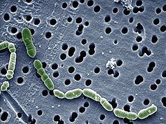 Oenococcus httpsuploadwikimediaorgwikipediacommonsthu