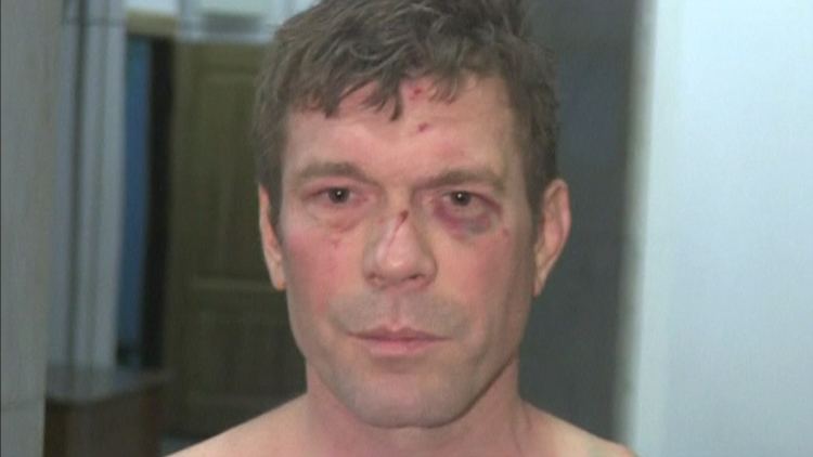 Oleg Tsaryov Mob Attacks ProRussian Politician in Kiev NBC Newscom