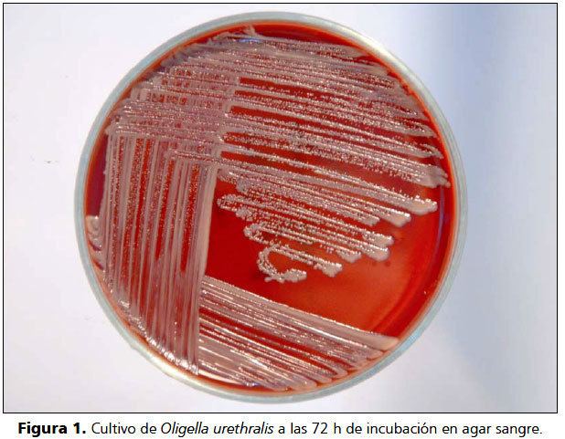Oligella (bacterium) wwwscieloclfbpeimgrciv29n1fig1601jpg