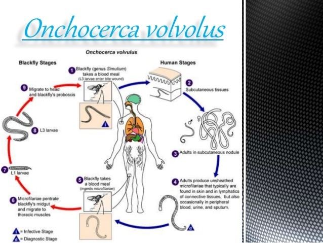 Onchocerca volvulus httpsimageslidesharecdncomonchocerca1601251