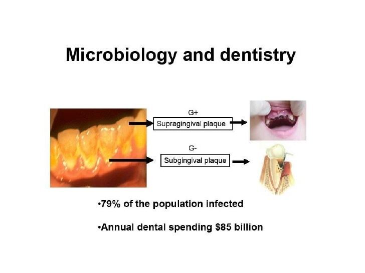 Oral microbiology Module 13 oral microbiology