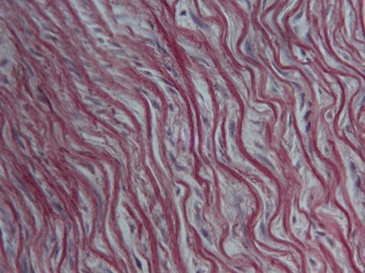 Orcein Aorta showing elastic fibers Stain Orcein Histology