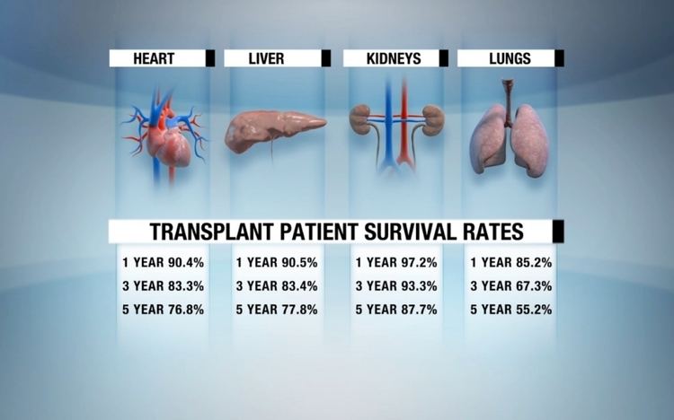 Organ transplantation A brief history of organ transplant technology from 800 BC to 2014