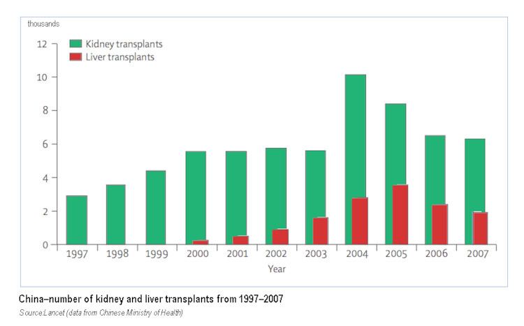 Organ transplantation in China