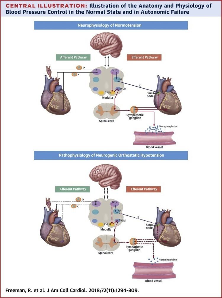 Orthostatic Hypotension: JACC State-of-the-Art Review - ScienceDirect