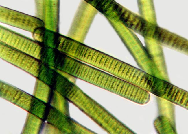 Oscillatoria Algae as seen when viewed using a microscope.