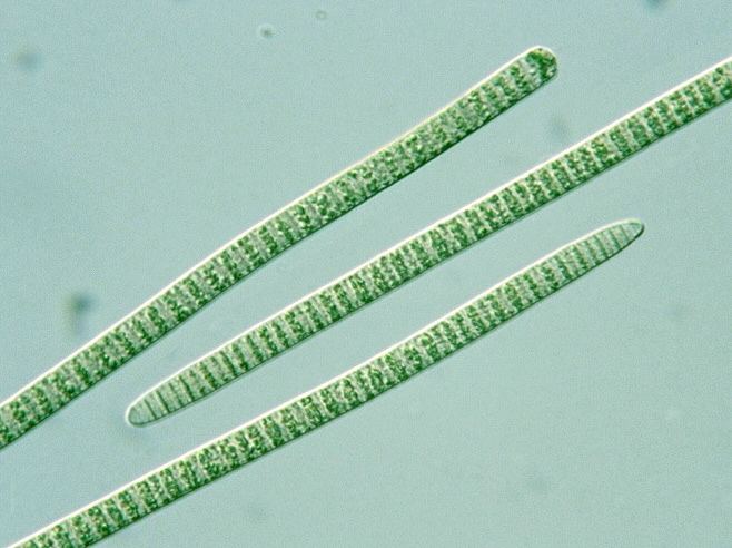 Oscillatoria Prokaryotes as they are seen when viewed using a microscope.