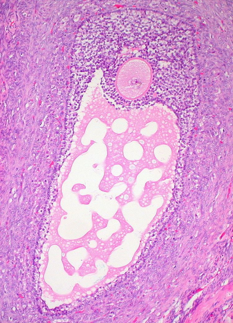 Ovarian follicle