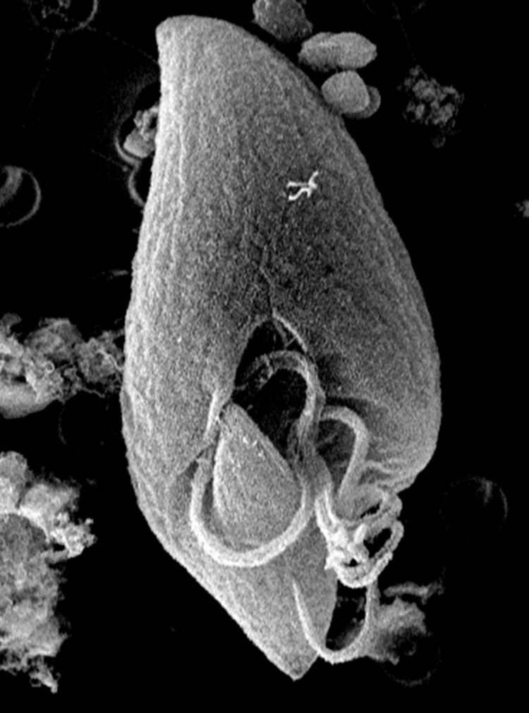 Oxyrrhis marina Oxyrrhis marina scanning electron micrograph Oxyrrhis ma Flickr