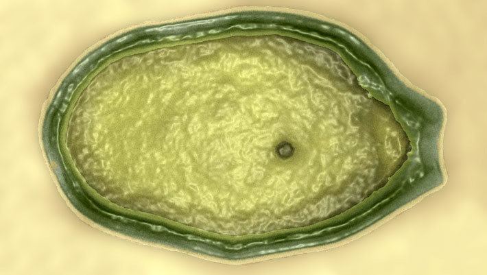 Pandoravirus Meet Pandoravirus Scientists Surprised to Discover New Giant