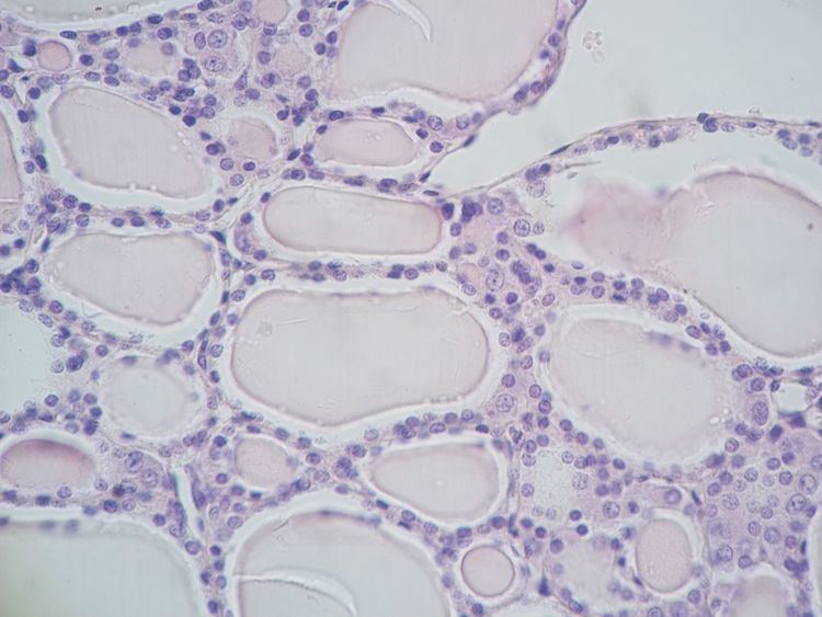 Parafollicular cell