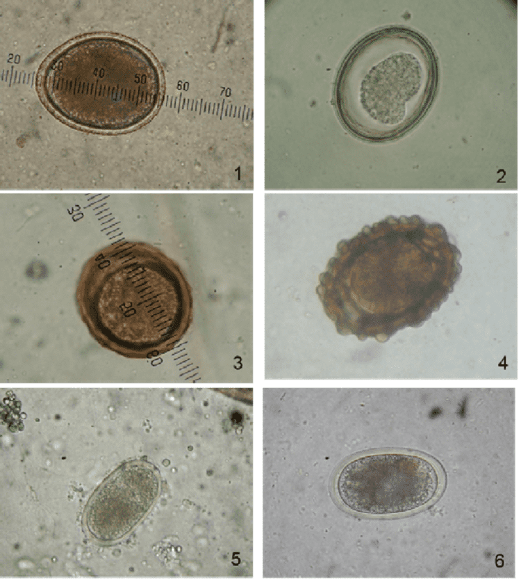 Clinical signs of infestation of Parascaris equorum