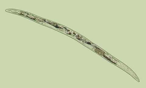 Paratrichodorus minor Diagnosis of Trichodorus obtusus and Paratrichodorus minor on