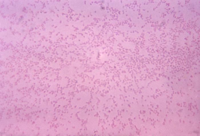 Pasteurella Pasteurella multocida GramNegative Bacteria Pathogen Profile