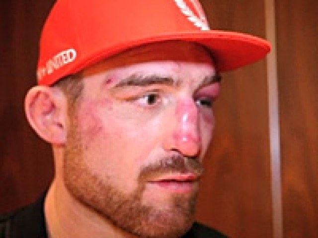 Pat Healy (fighter) Pat quotBam Bamquot Healy MMA Stats Pictures News Videos