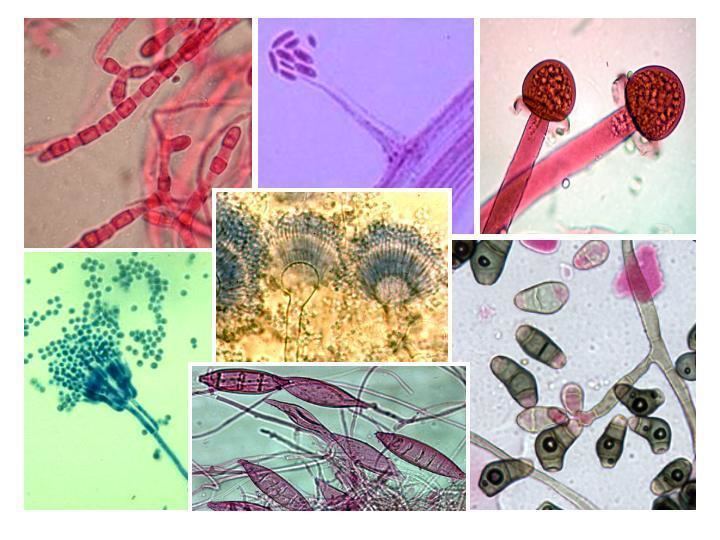 Pathogenic fungus Culture Collections