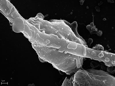 Pathogenic fungus fungi as human pathogens stellarcomezecom