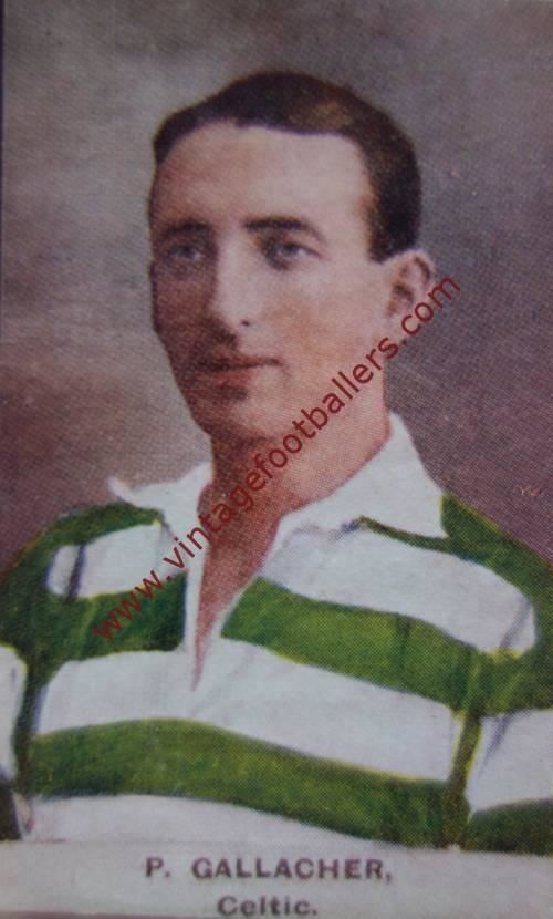 Patsy Gallacher Gallacher Patsy Image 3 Celtic 1920 Vintage Footballers