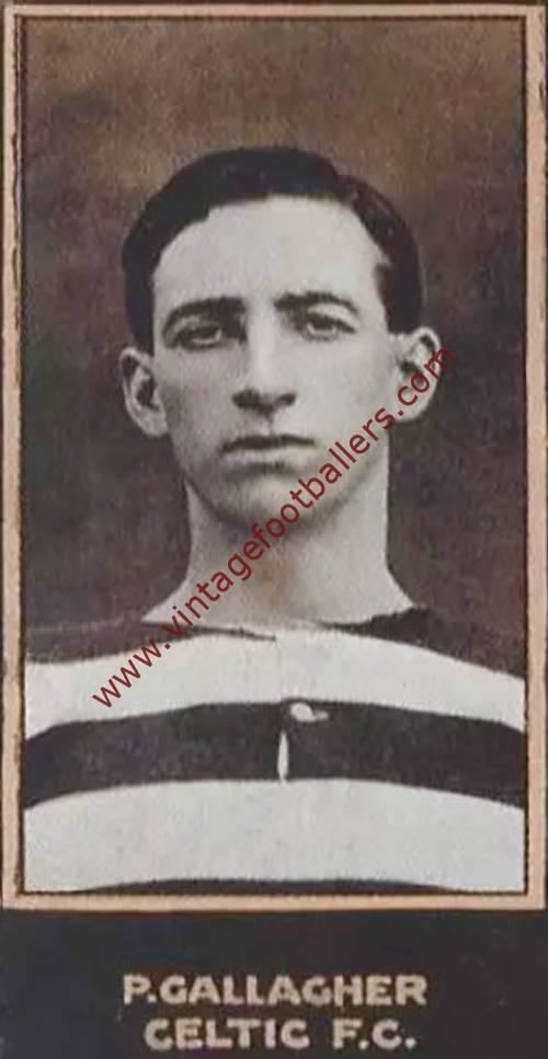 Patsy Gallacher Gallacher Patsy Image 4 Celtic 1922 Vintage Footballers