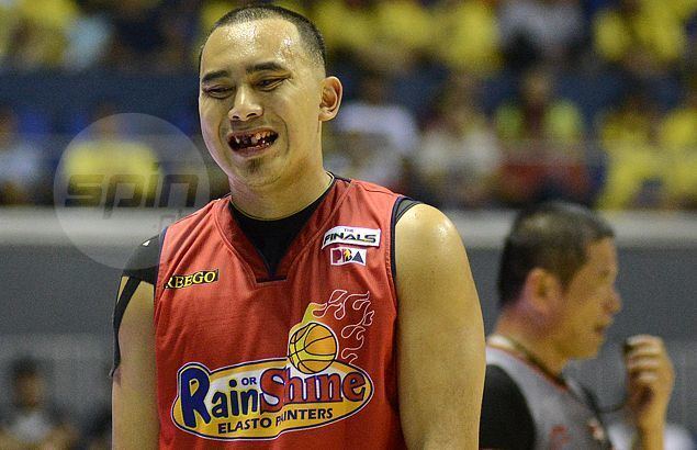 Paul Lee (basketball) Paul Lee ready to play in Game Four after two front teeth saved in