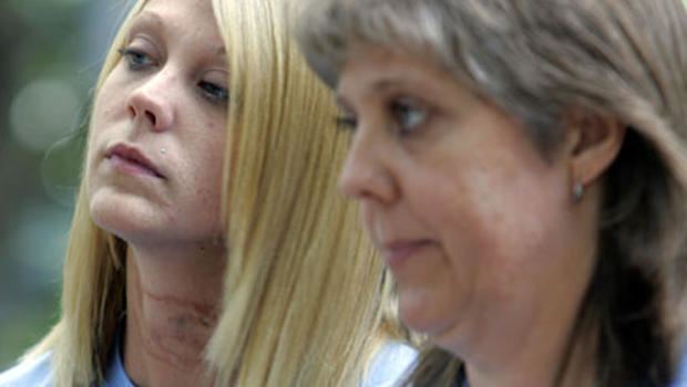 Kristie Reed and her mother are looking at something while Kristine has a scar on her neck