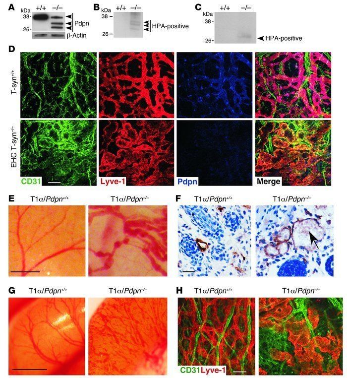 PDPN JCI Endothelial cell Oglycan deficiency causes bloodlymphatic