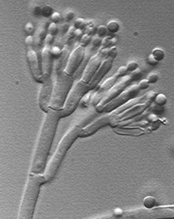 Penicillium as seen when viewed in a microscope with a gray color.