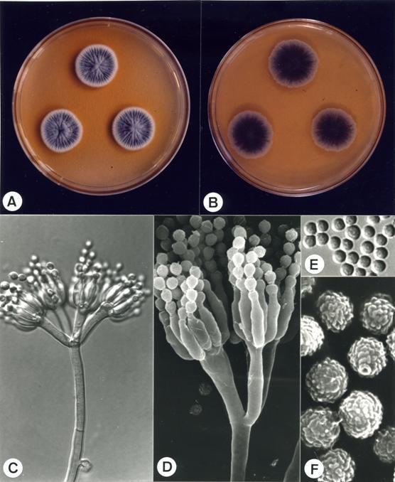 Penicillium citrinum Anamorphic fungi gtgt Anamorphic fungi gtgt Anamorphic fungi