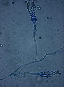 Penicillium as seen when viewed in a microscope with its blue color.