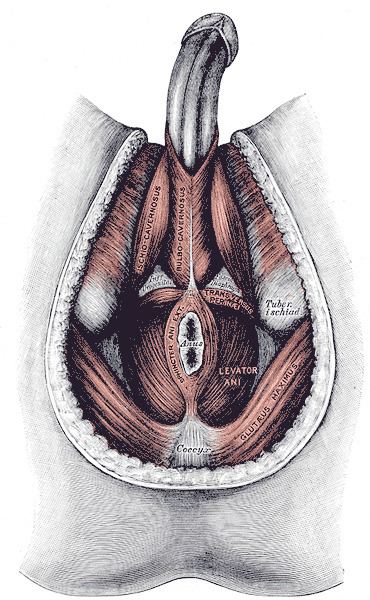 Perineal hernia