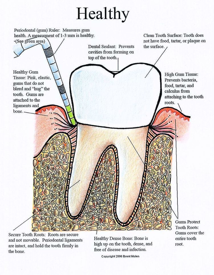 Periodontal charting
