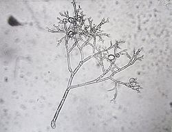 Peronospora hyoscyami f.sp. tabacina Peronospora hyoscyami fsp tabacina Wikipedia