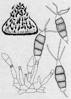 Pestalotiopsis Pestalotiosis