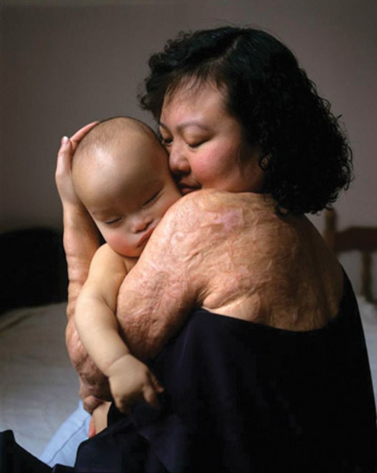 Phan Thi Kim Phuc smiling while hugging a sleeping baby in a bed, Phan has black kinky short hair wearing a black off-shoulder top showing her burn scars