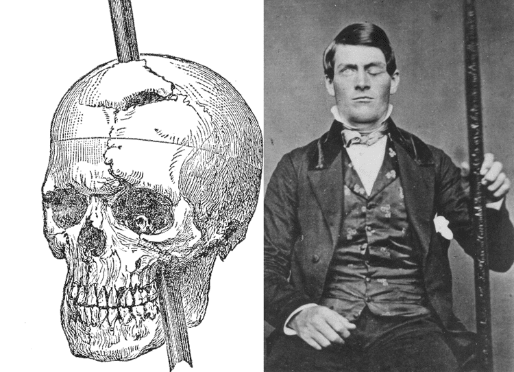 Phineas Gage What Really Happened to Phineas Gage Psychology39s Most