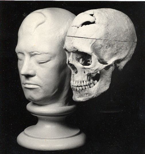 Phineas Gage Who was Phineas Gage Countway Library of Medicine