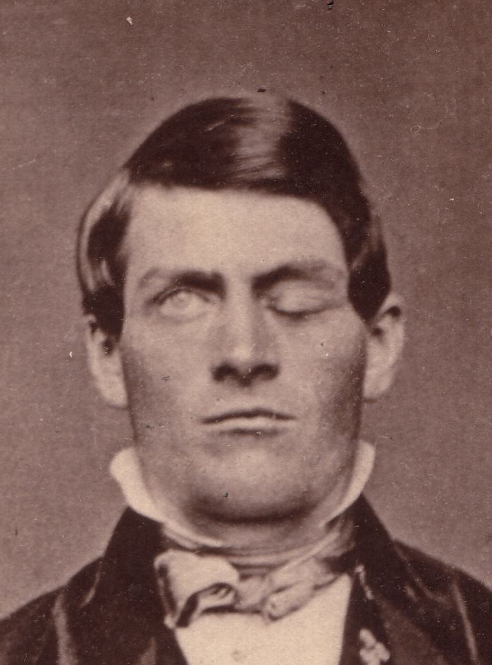 Phineas Gage Phineas Gage The Business of Emotions