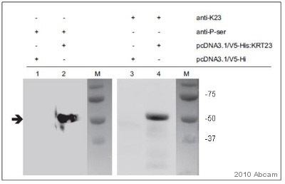 Phosphoserine AntiPhosphoserine antibody ab9332 Abcam