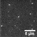 Photoactivated localization microscopy