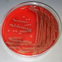 Photobacterium damselae subsp. piscicida httpsuploadwikimediaorgwikipediacommonsthu
