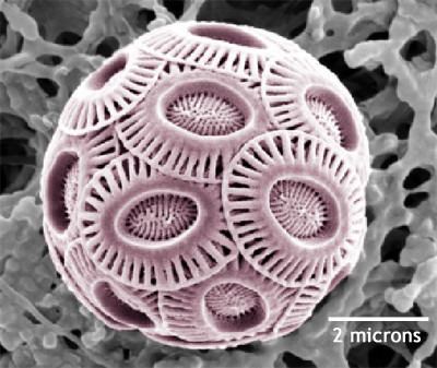 Phycodnaviridae Scanning Electron Microscopy picture of Emiliania huxle Openi