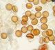 Physoderma Physoderma asphodeli de Bary Karling a chytridiomycete fungus