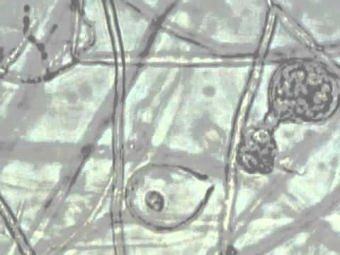 Phytophthora palmivora Phytophthora palmivora zoospore discharge YouTube